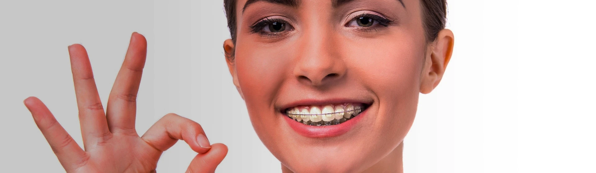 Керамические брекеты в частной стоматологии Оксфорд Медикал Киев