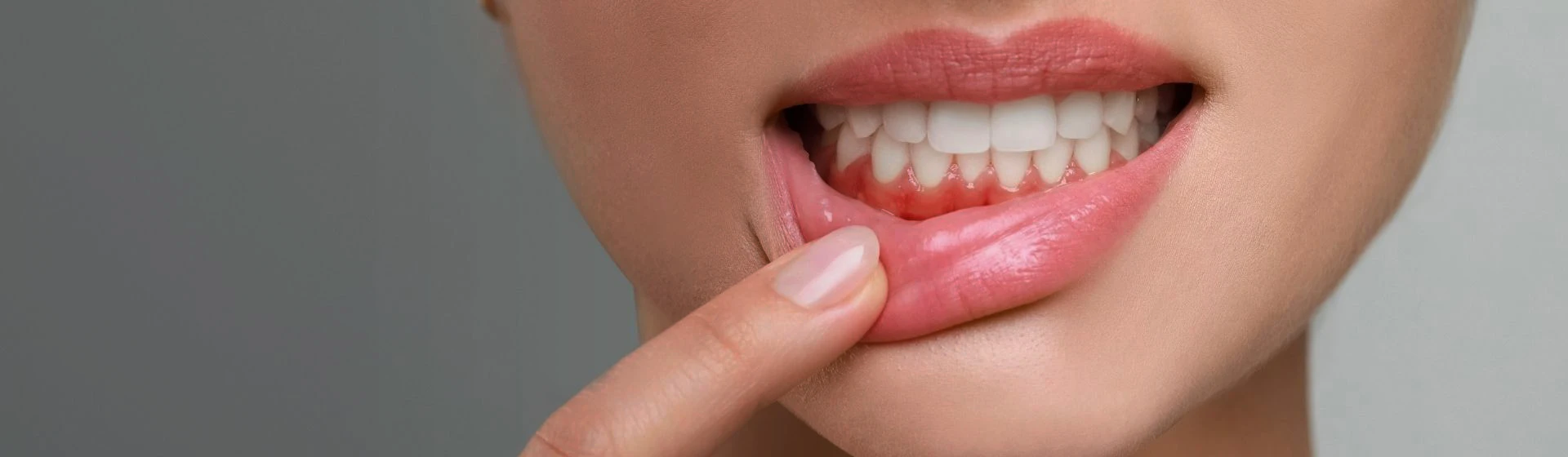 Лечение пародонтита в частной стоматологии Оксфорд Медикал Киев