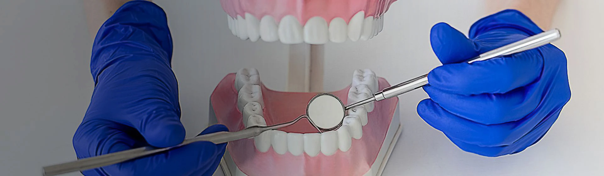 Шинирование зубов в частной стоматологии Оксфорд Медикал Киев