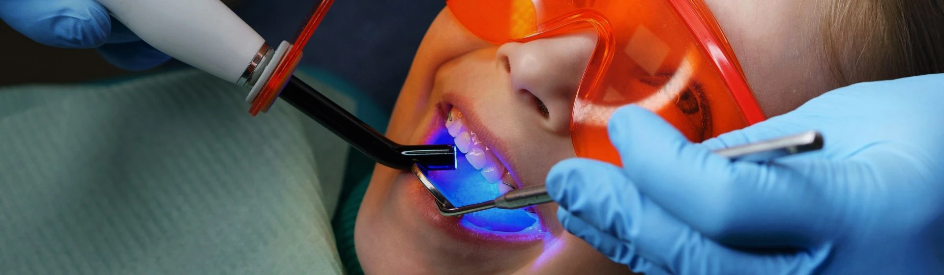 Лечение молочных зубов в частной стоматологии Оксфорд Медикал Киев