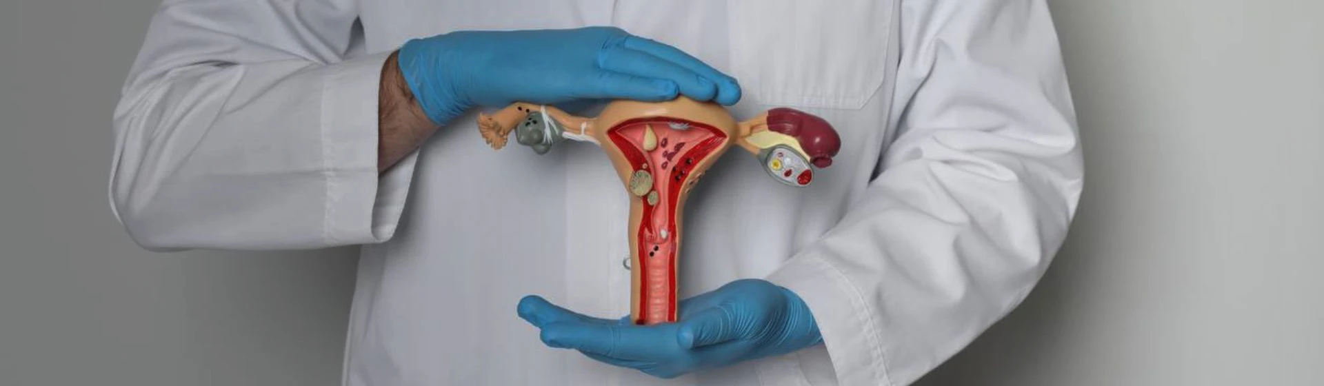 Видалення кісти яєчника у приватній клініці Оксфорд Медікал Київ