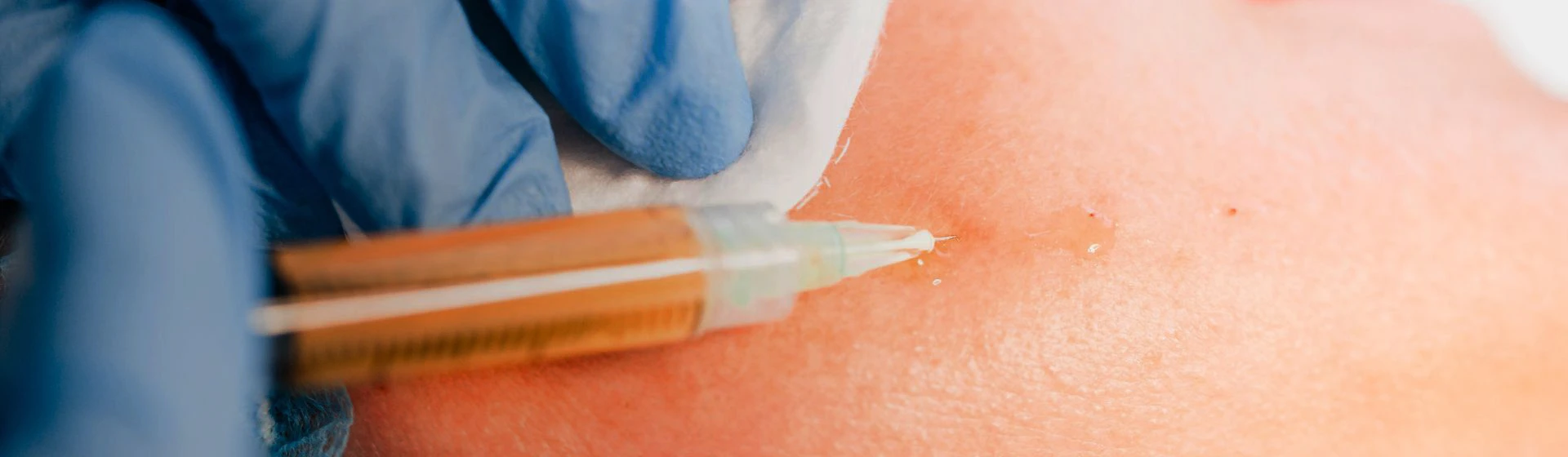 Блокады при болях в суставах в частной клинике Оксфорд Медикал Киев