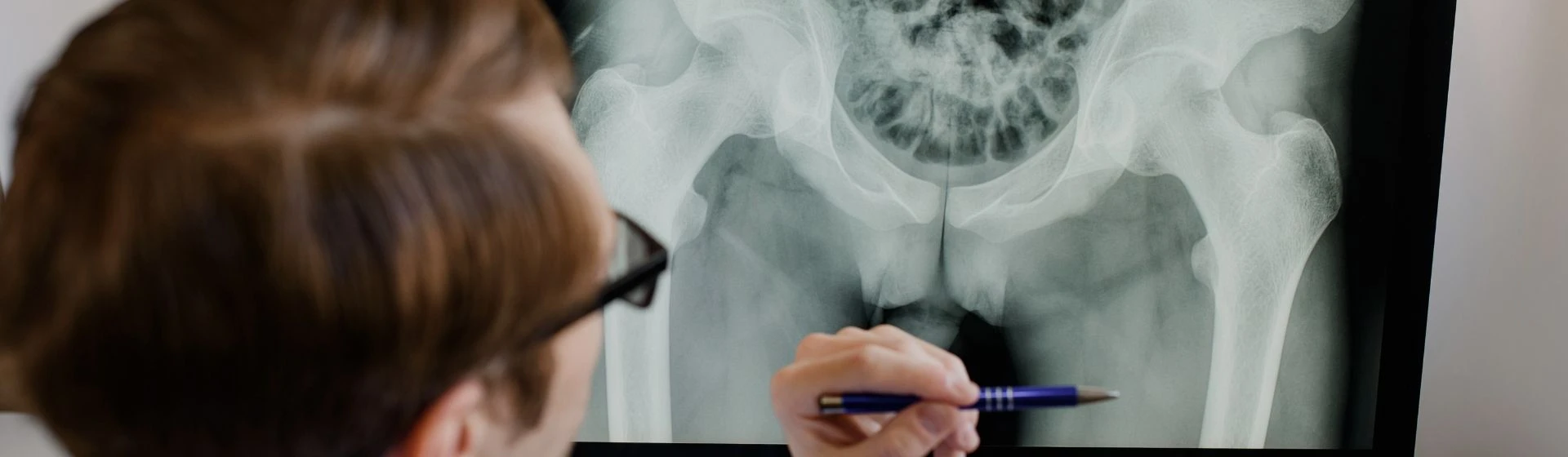 Рентген копчика в частной клинике Оксфорд Медикал Киев