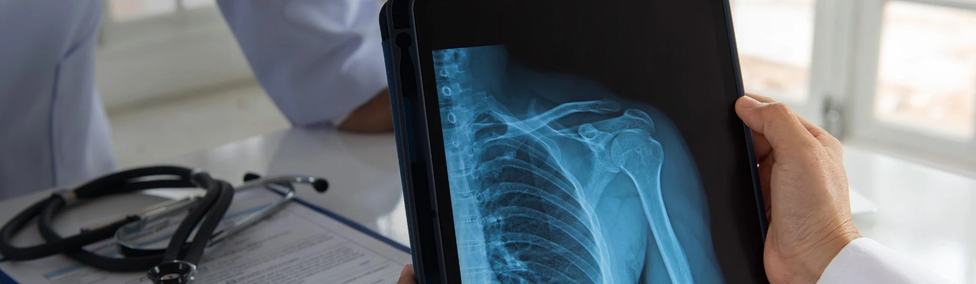 Рентген плечевого сустава в частной клинике Оксфорд Медикал Киев