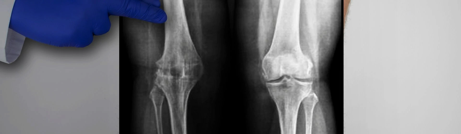 Рентген колен в частной клинике Оксфорд Медикал Киев