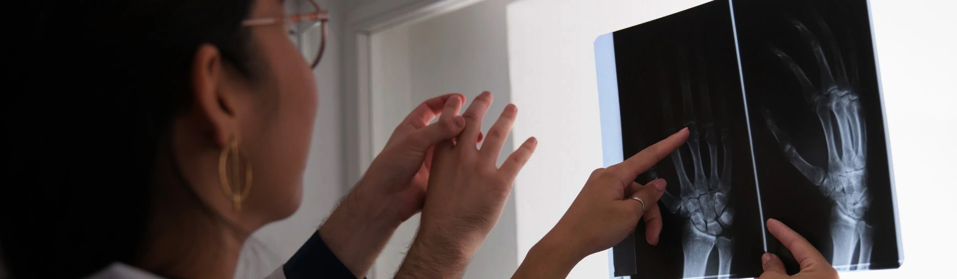 Рентген руки в частной клинике Оксфорд Медикал Киев