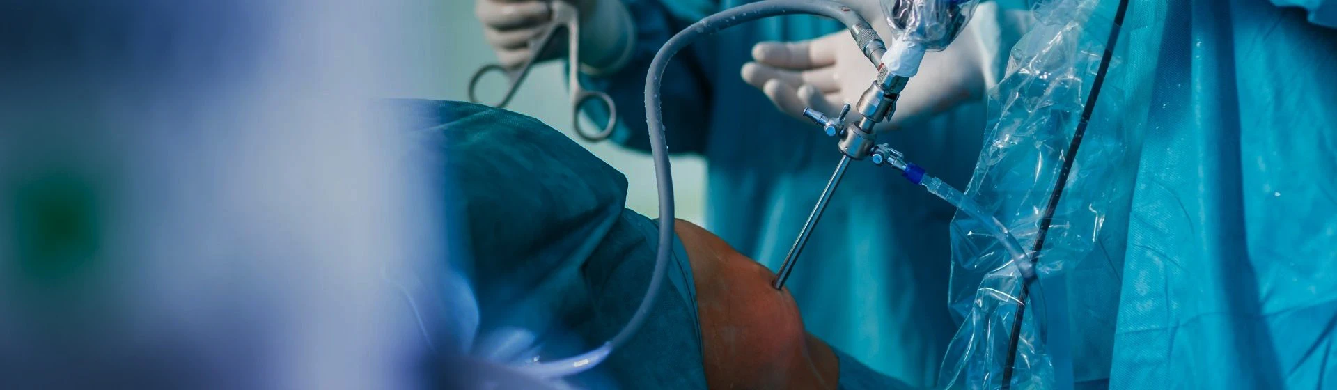 Артроскопия коленного сустава в частной клинике Оксфорд Медикал Киев