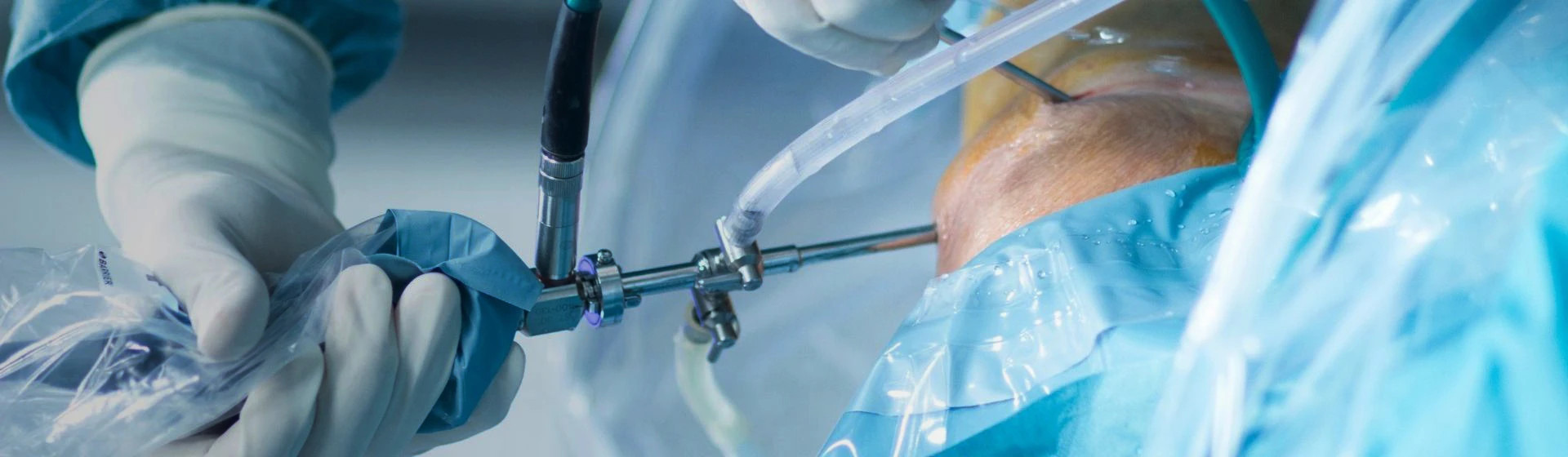 Эндопротезирование плечевого сустава в частной клинике Оксфорд Медикал Киев