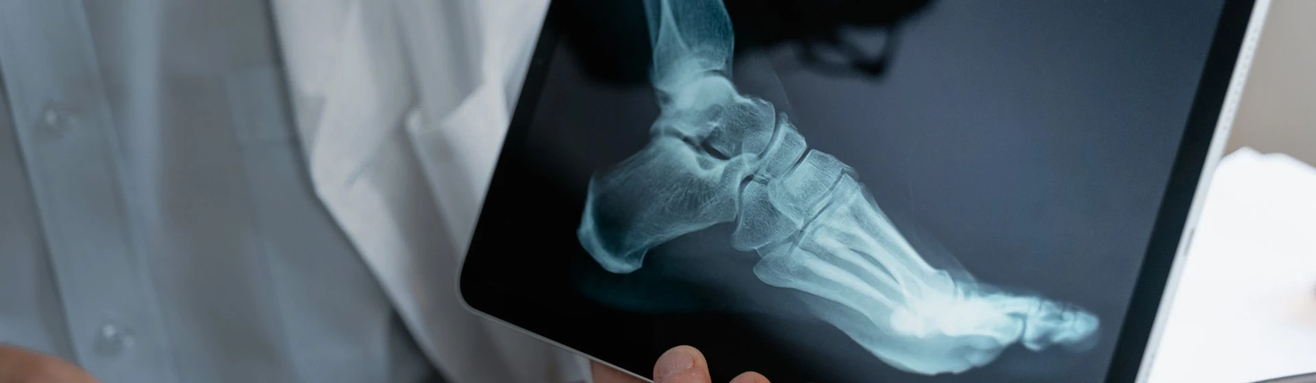 Хирургическое лечение вальгусной деформации стопы в частной клинике Оксфорд Медикал Киев