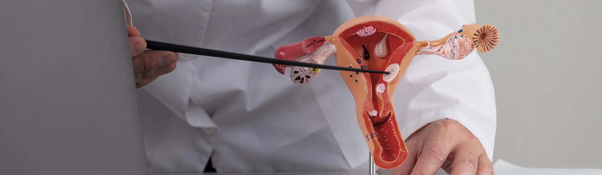 Лечение рака шейки матки в частной клинике Оксфорд Медикал Киев