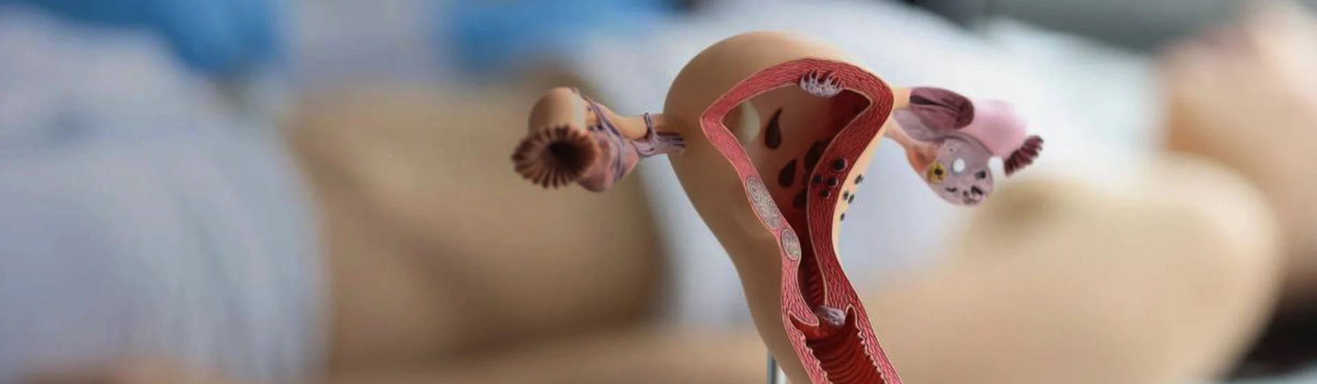 Лікування раку піхви у приватній клініці Оксфорд Медікал Київ