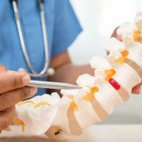 Спондильоз та спондилоартроз: що це таке