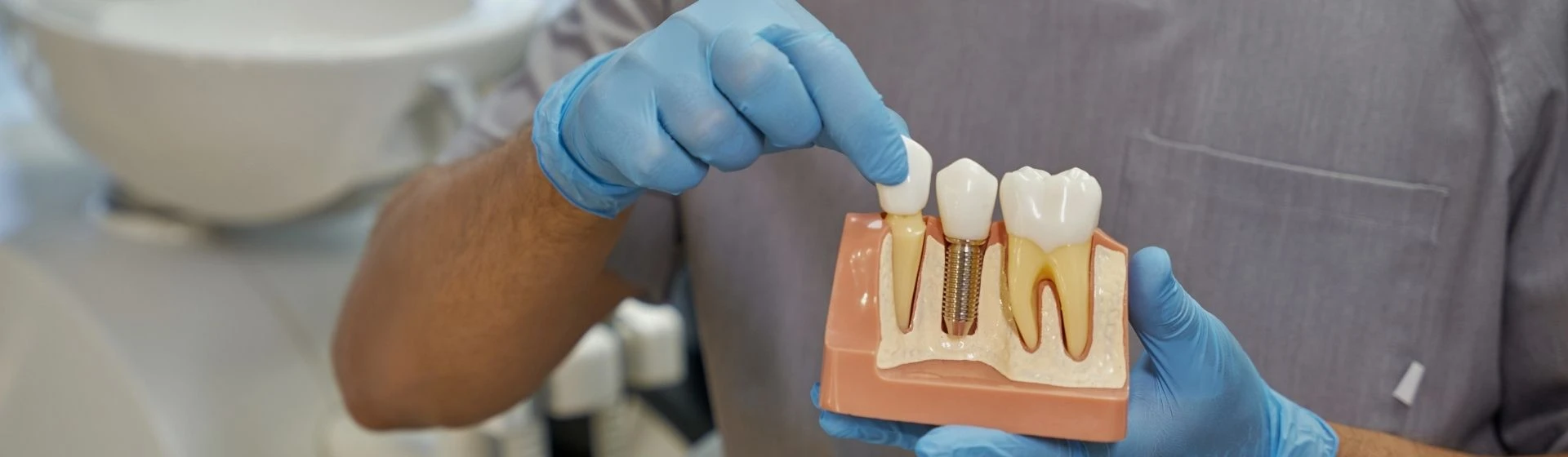 Импланты Straumann — цены на зубные импланты Штрауман в Киеве | Оксфорд Медикал