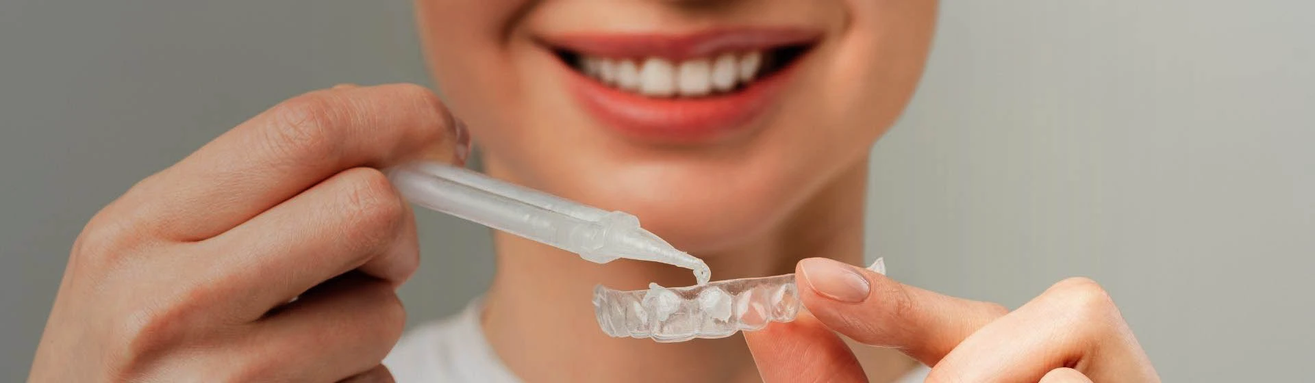 Капа для отбеливания зубов — цены на отбеливающие капы в Киеве | Оксфорд Медикал