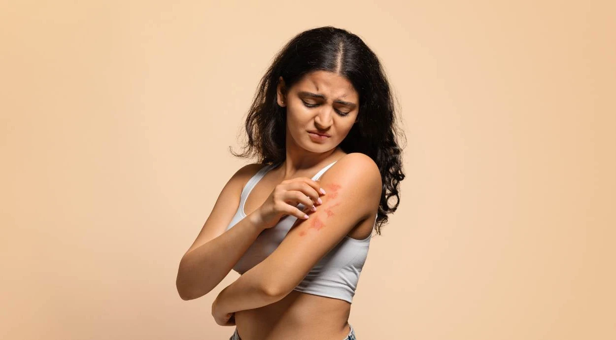 Що таке псоріаз та як розпізнати перші симптоми