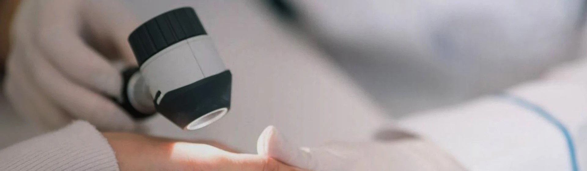 Лечение контактного дерматита