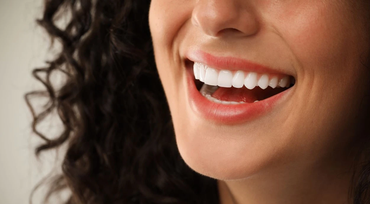 Что такое виниры: виды виниров, их плюсы и минусы