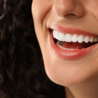 Что такое виниры: виды виниров, их плюсы и минусы