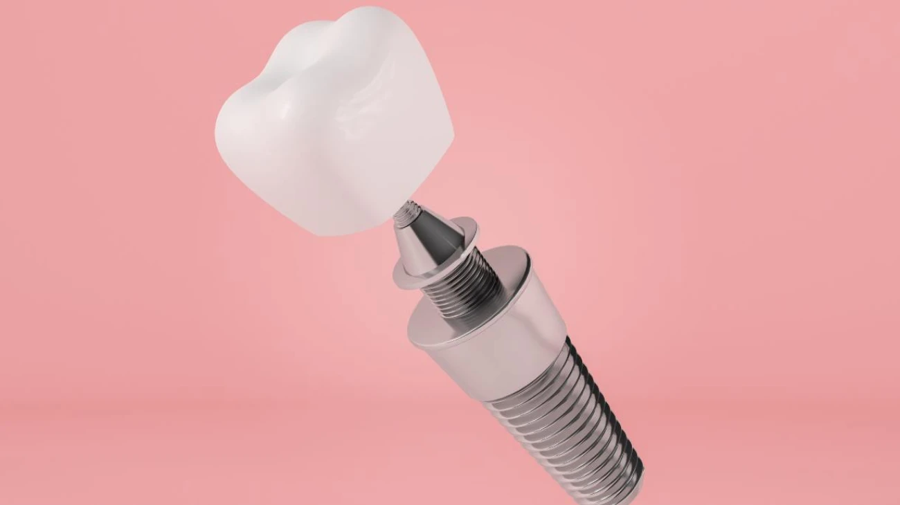 Акция! Имплант под ключ A.V. Dent (Израиль, премиум)