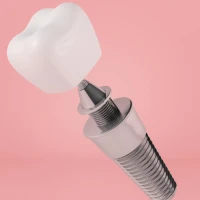 Акция! Имплант под ключ A.V. Dent (Израиль, премиум)