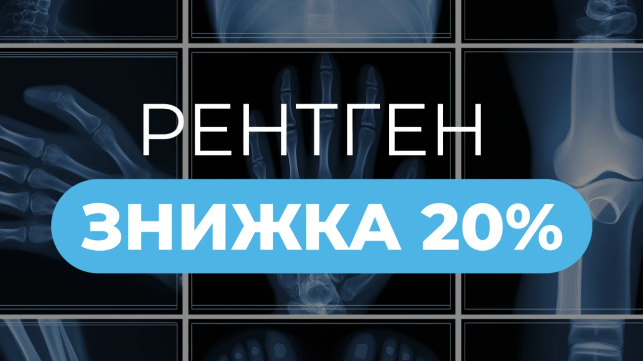 Знижка 20% на рентгенографію