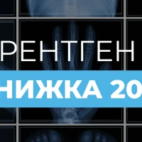 Знижка 20% на рентгенографію