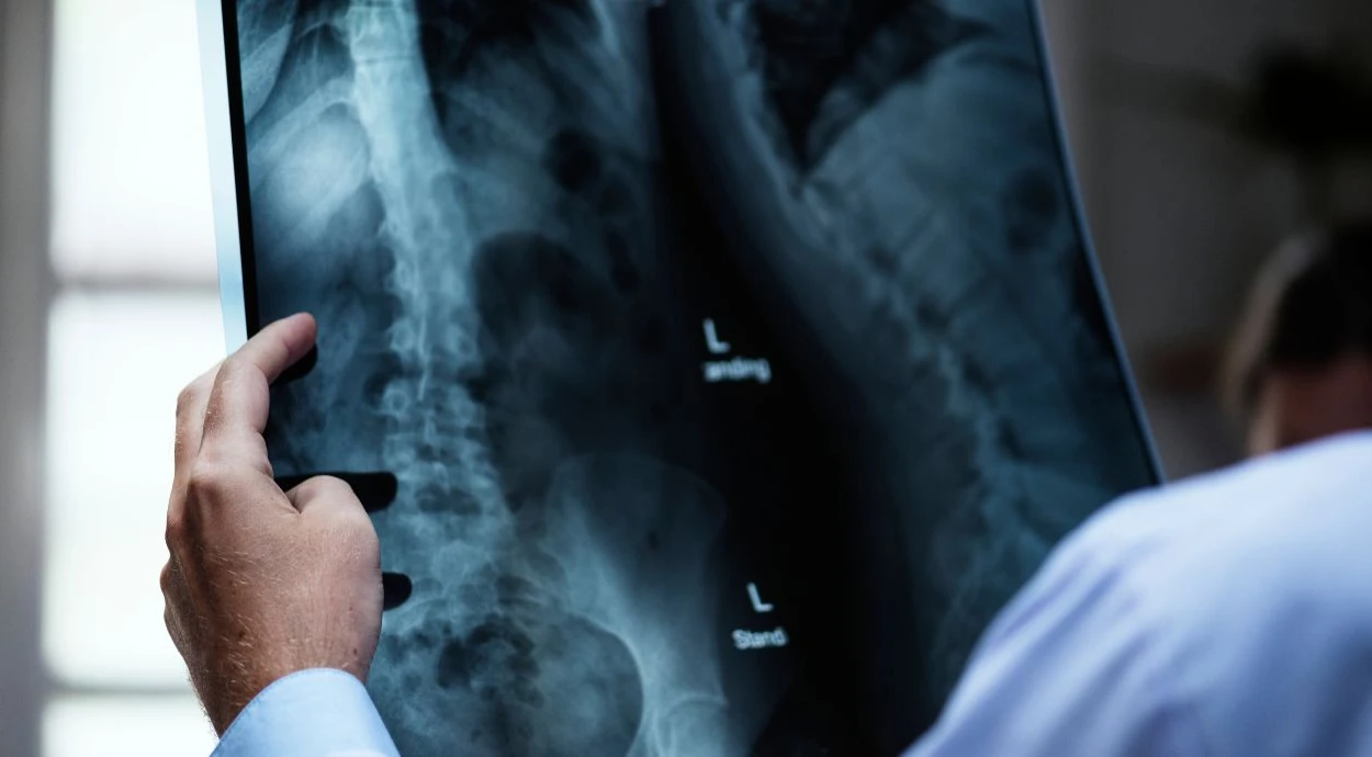 How to prepare for an x-ray of the lumbosacral spine