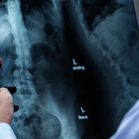 Как подготовиться к рентгену пояснично-крестцового отдела позвоночника