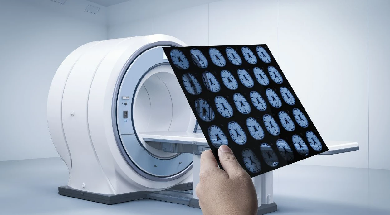 What is the difference between CT and MRI: which diagnosis to choose?