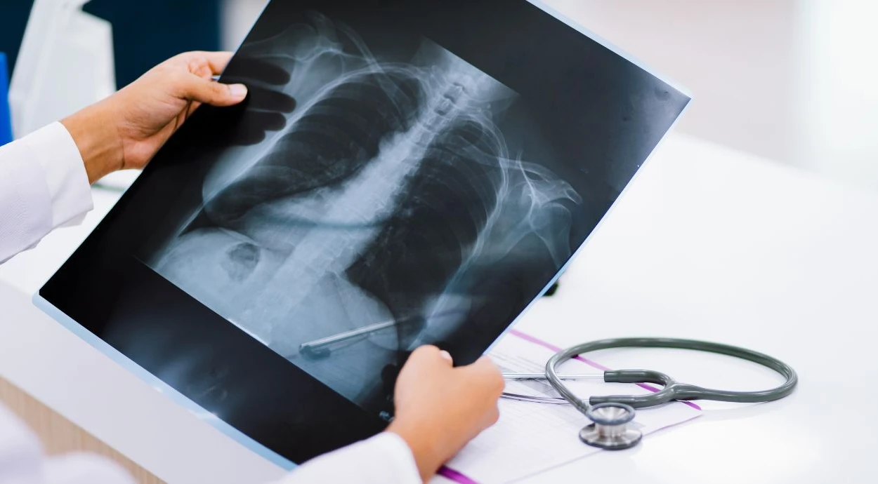 Чем отличается рентген от флюорографии