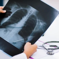 Чем отличается рентген от флюорографии