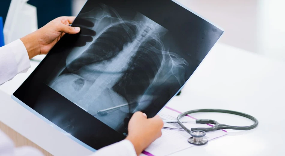 Чем отличается рентген от флюорографии