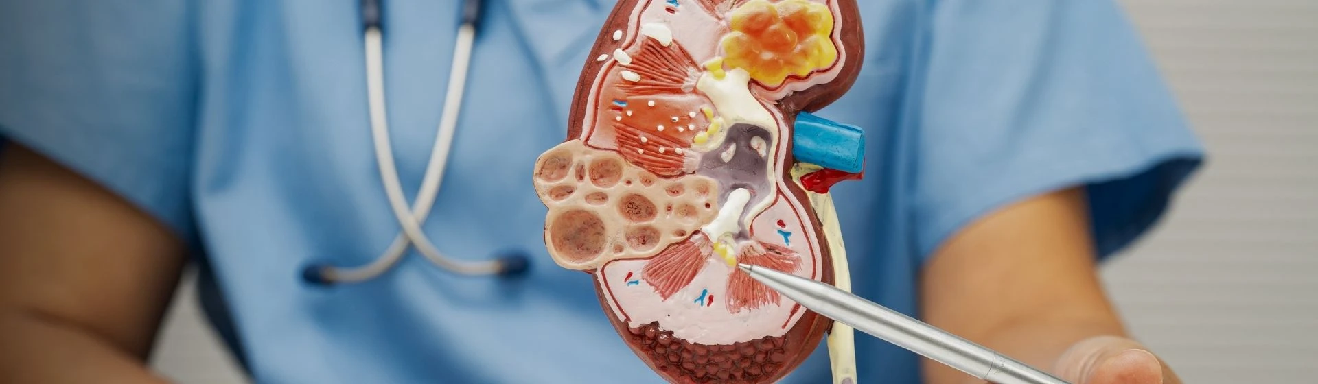 Камни в почках ➤ симптомы и лечение нефролитиаза в Киеве | Оксфорд Медикал