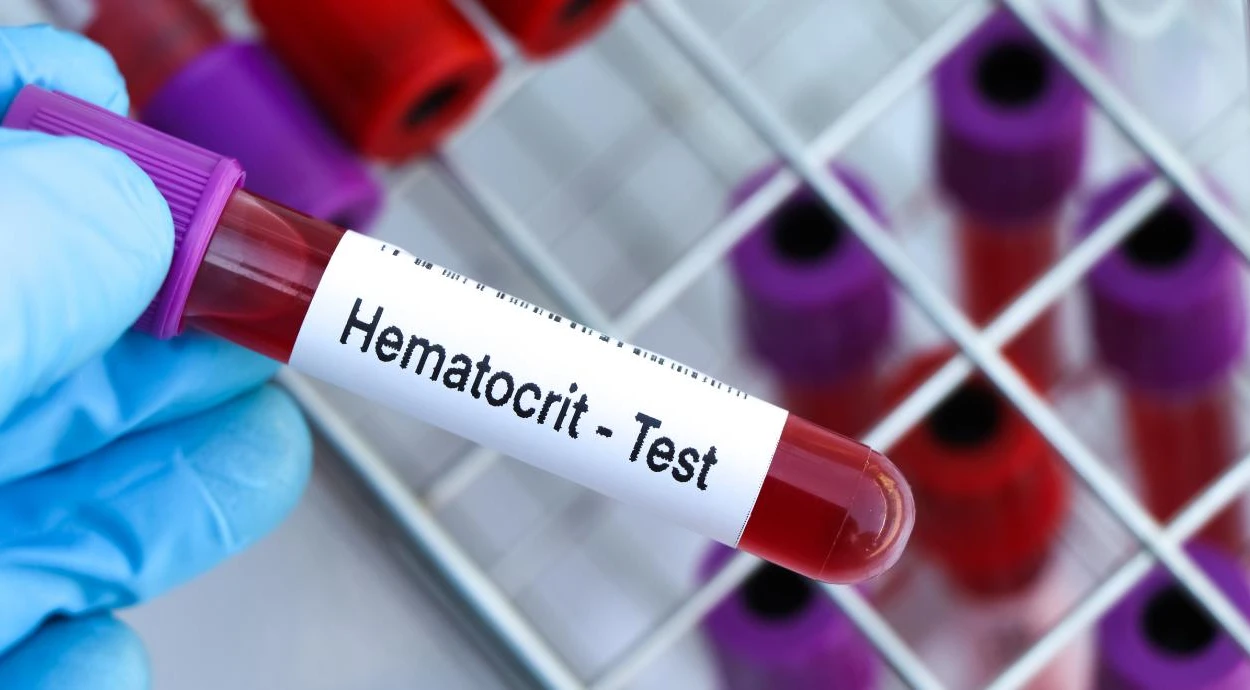 Що таке гематокрит (HCT): норма, причини відхилень та що робити