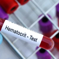 What is hematocrit (HCT): norm, causes of deviations and what to do
