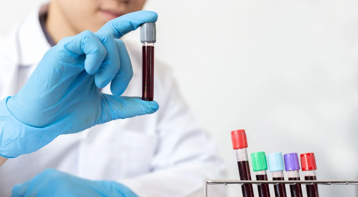 Що таке лейкоцити: яка норма та що робити при відхиленнях