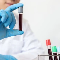 Що таке лейкоцити: яка норма та що робити при відхиленнях