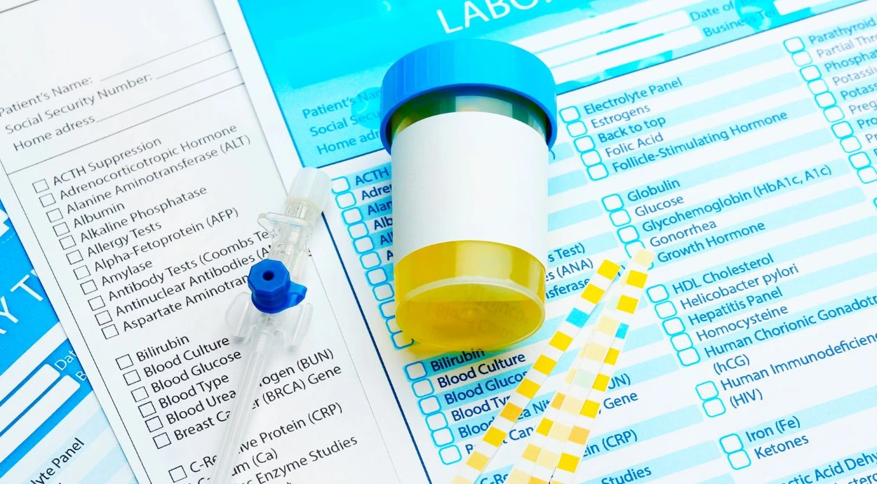 Протеинурия: что означает белок в моче и какая норма