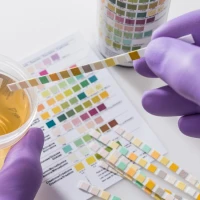 Гематурия: о чем свидетельствует кровь в моче