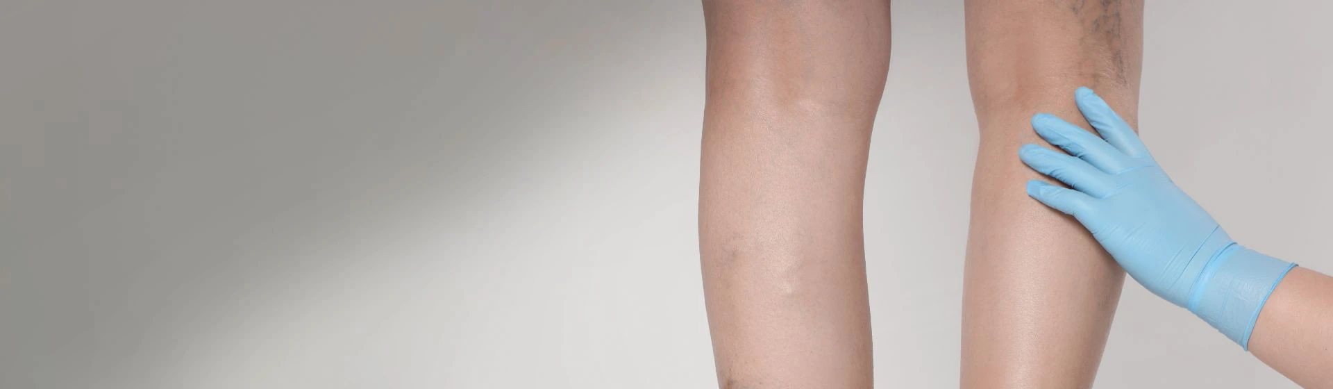 Trophic ulcer ➤ treatment of varicose ulcers on the legs in Kyiv | Oxford Medical