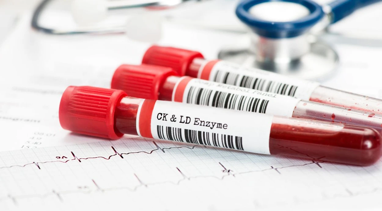 C-reactive protein: when to take it and what the test shows