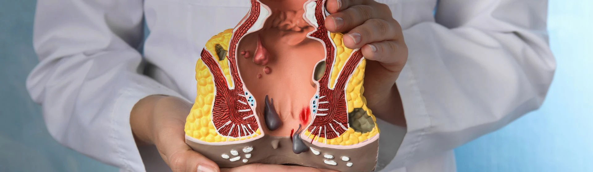 Anoscopy at the private clinic Oxford Medical Kyiv