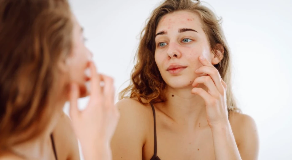 Flaky Skin on the Face: Causes and How to Get Rid of It